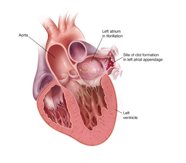 Tests & Procedures | The Chattanooga Heart Institute